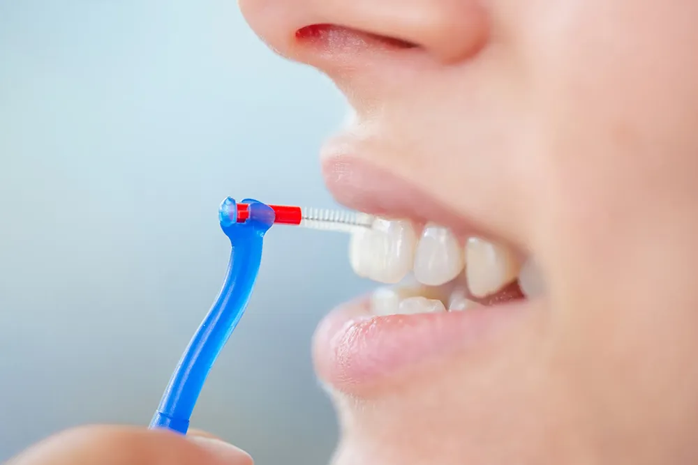 Cara Yang Betul untuk Menggunakan Berus Interdental
